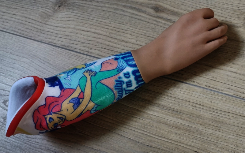 Elektrohand 2000 Ottobock