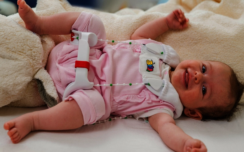 Tuebinger Hueftbeugeschiene