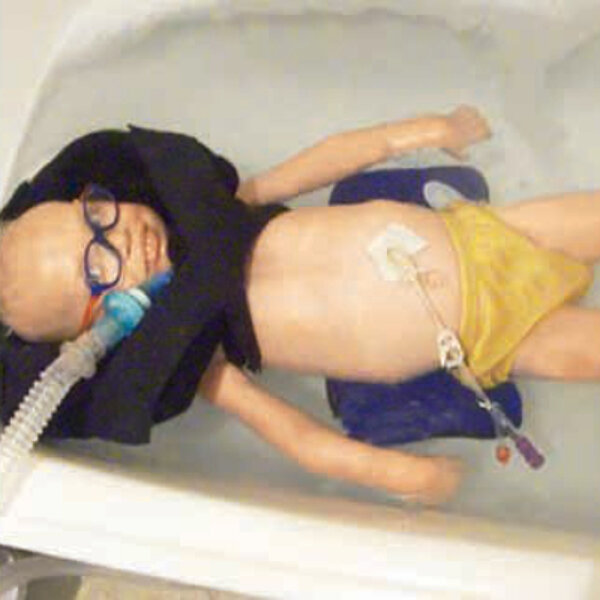 Schwimmhilfe badehilfe Nackenstuetze rehakind Kinderhilfsmittel