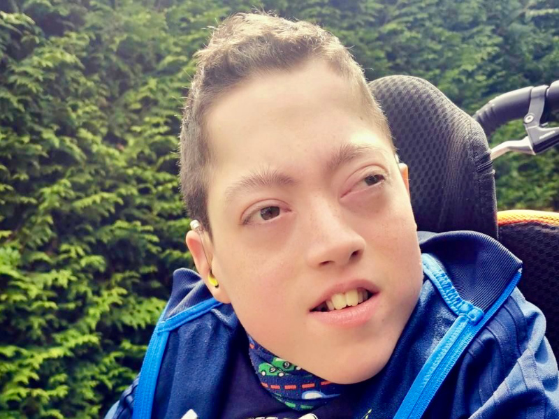 Bohring-Opitz-Syndrom-FiNiFuchs Bohring-Opitz-Syndrom-FiNiFuchs